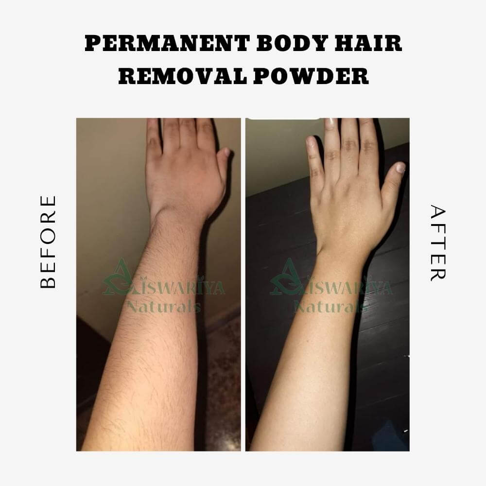 Permanent Body Hair Removal