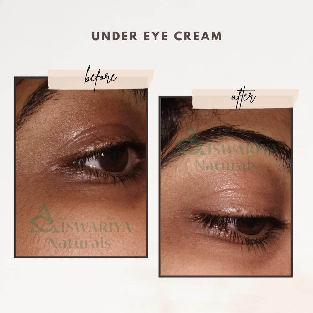 Under eye cream